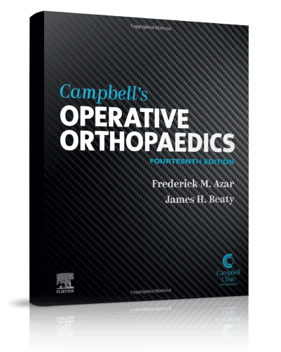 Operative Orthopaedics | Campbell Clinic Foundation